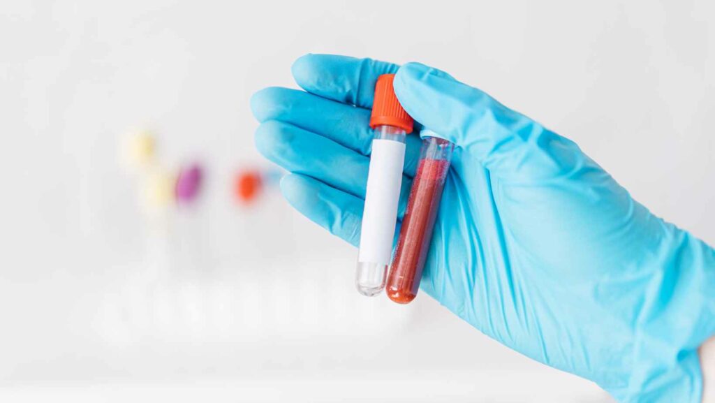 How to Craft Empty Vial Dreamlight Valley A Comprehensive DIY Guide Important Cool